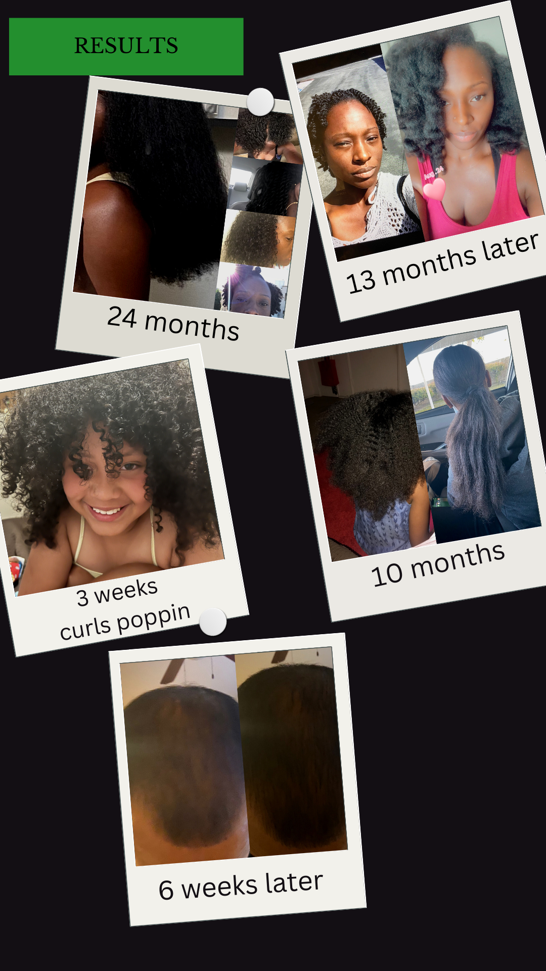London Michelle Hair Growth Oil