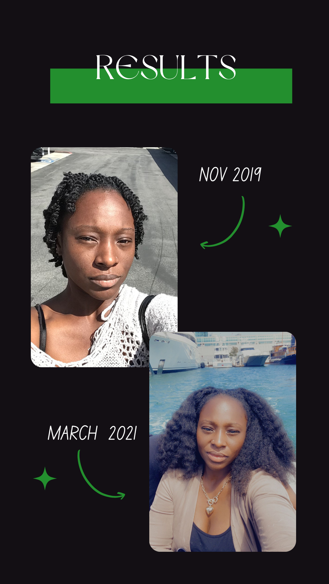 London Michelle Hair Growth Oil